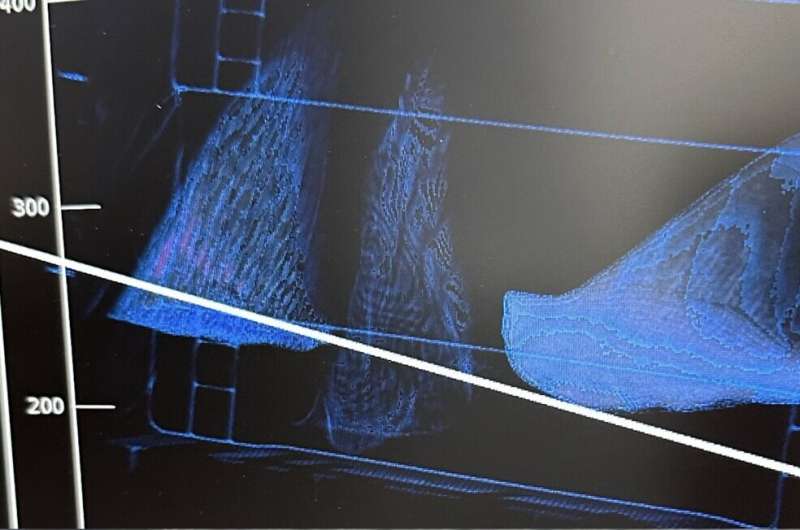 AI 算法助力打击海洋野生动物走私，识别准确率达 92%，网友热议